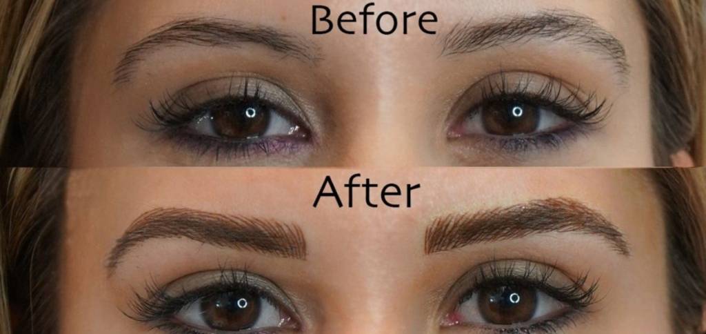 Microblading Treatment in Setibamedicalspa Westlake Village CA
