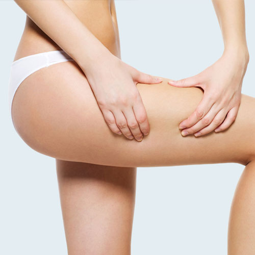 Morpheus8 Cellulite Treatment in Setibamedicalspa Westlake Village CA